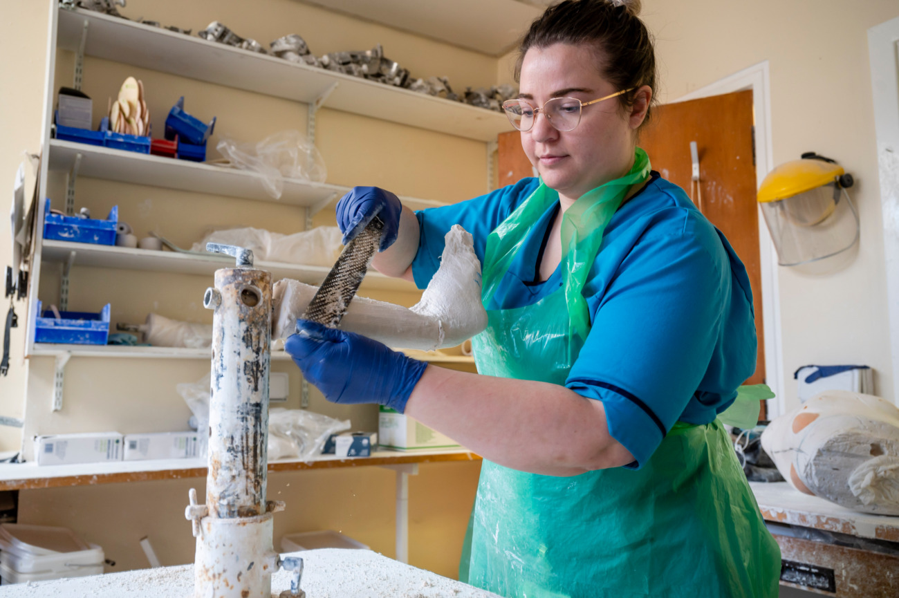 Orthotics Service Creating Orthosis